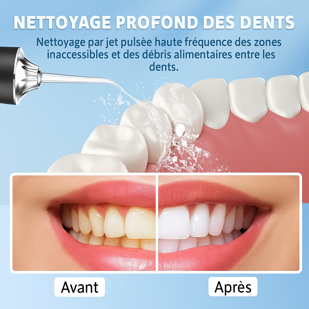 Nettoyeur Dentaire Pro