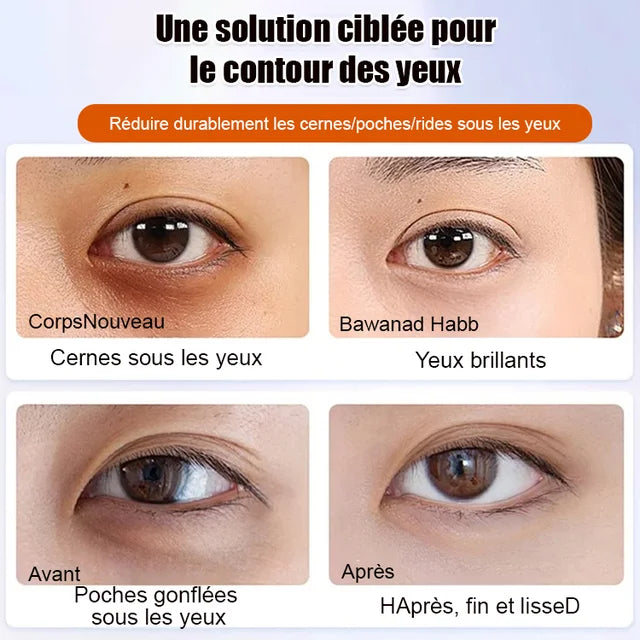 Sérum Contour des Yeux – Anti-Rides
