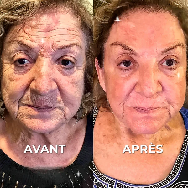 Botox Naturel  Sérum Anti-Âge Rapide et Efficace