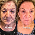 Charger l&#39;image dans la galerie, Botox Naturel  Sérum Anti-Âge Rapide et Efficace
